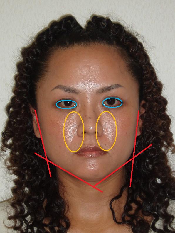 �֊s�����O